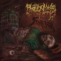 Purchase Phalloplasty MP3