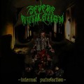 Purchase Severe Mutilation MP3